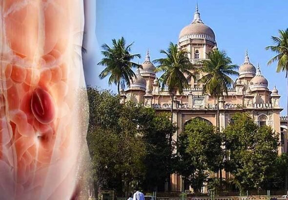 Osmania General Hospital building, Hyderabad