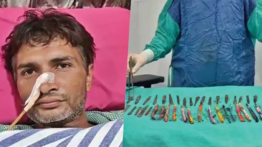 Doctors in Hapur remove 29 steel spoons and 19 toothbrushes from a man’s stomach.